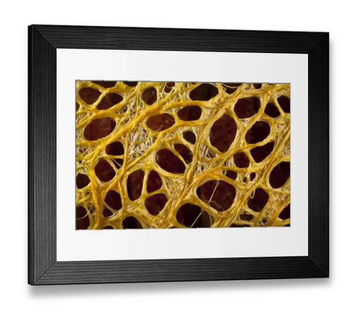Framed Print : Cricula silkmoth (Cricula trifenestrata) close up of cocoon showing silk fibres originating Framed Print : Cricula silkmoth (Cricula trifenestrata) close up of cocoon showing silk fibres originating