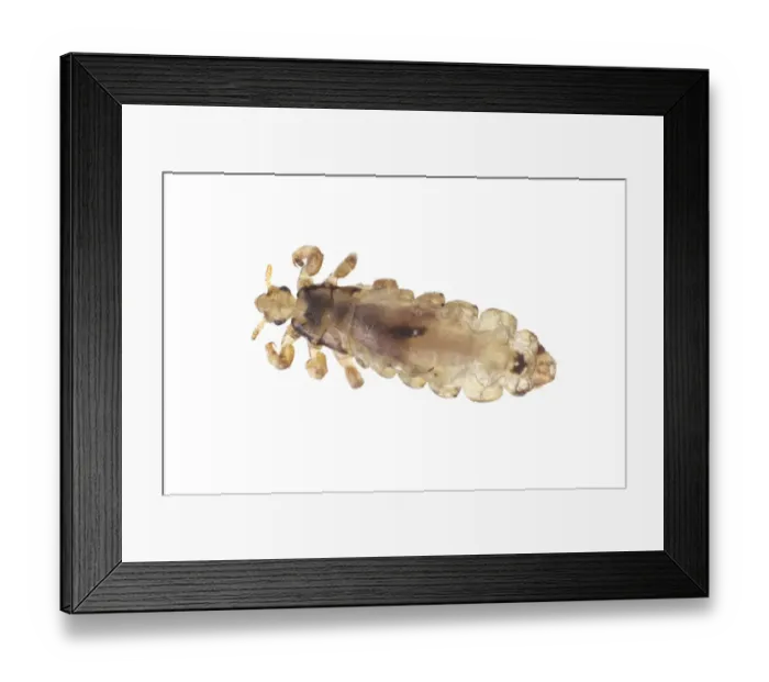 Framed Print : Head Louse (Pediculus humanus capitus) Brackenridge Field Laboratory, Austin, Travis County Framed Print : Head Louse (Pediculus humanus capitus) Brackenridge Field Laboratory, Austin, Travis County