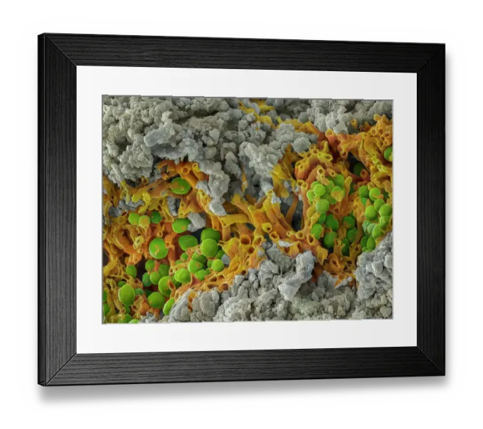 Framed Print : False-coloured scanning electron micrograph of a cleaved sample of a crustose lichen growing on grey limestone, the orange are fungal threads and the green shows algal cells Framed Print : False-coloured scanning electron micrograph of a cleaved sample of a crustose lichen growing on grey limestone, the orange are fungal threads and the green shows algal cells