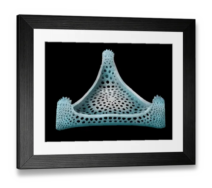 Framed Print : Diatom (Triceratium heibergii). The silica skeleton of a diatom includes a pair of valve sections, one of which is shown here. False-coloured scanning electron micrograph (SEM) Framed Print : Diatom (Triceratium heibergii). The silica skeleton of a diatom includes a pair of valve sections, one of which is shown here. False-coloured scanning electron micrograph (SEM)