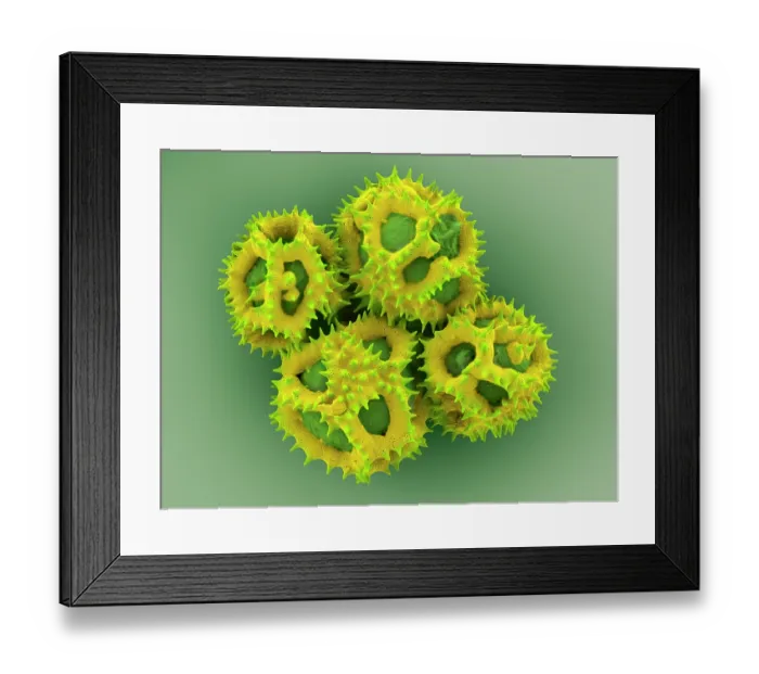 Framed Print : Dandelion (Taraxacum officinale) pollen. False-coloured Scanning Electron Micrograph. Each pollen grain is approximately 25µm across Framed Print : Dandelion (Taraxacum officinale) pollen. False-coloured Scanning Electron Micrograph. Each pollen grain is approximately 25µm across