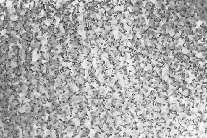 Framed Print : Close-up view of egg mass of Giant cusk-eel (Spectrunculus grandis) floating at the ocean surface. Each egg is less than 2mm in size Framed Print : Close-up view of egg mass of Giant cusk-eel (Spectrunculus grandis) floating at the ocean surface. Each egg is less than 2mm in size