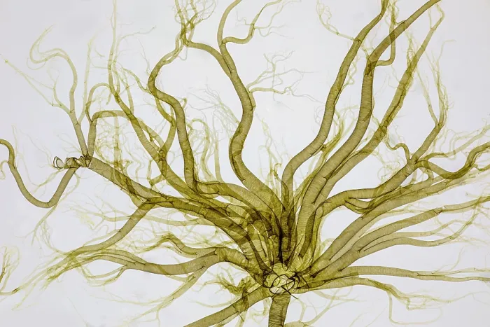 Framed Print : Trachea and tracheoles of a Silkworm (Bombycidae) caterpillar, imaged from an antique microscope slide Framed Print : Trachea and tracheoles of a Silkworm (Bombycidae) caterpillar, imaged from an antique microscope slide
