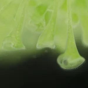 Trumpet animalcules (Stentor polymorphus) with algal symbionts (Chlorella), Europe