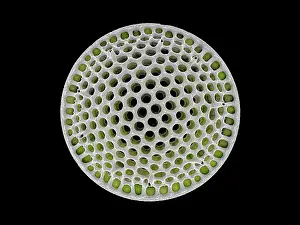 False Coloured Prints: Diatom (Stephanopyxis grunowii)