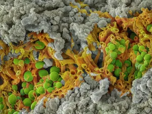 October 2022 Highlights Prints: False-coloured scanning electron micrograph of a cleaved sample of a crustose lichen growing on grey limestone