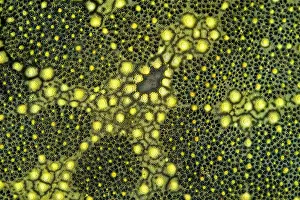 Papua New Guinea Prints: Detail of the surface of a Spiny cushion starfish (Culcita schmideliana) showing madreporite