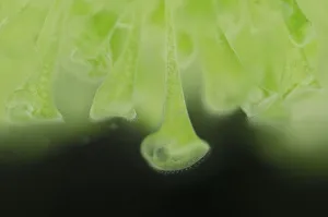 Trying Prints: Trumpet animalcules (Stentor polymorphus) with algal symbionts (Chlorella), Europe
